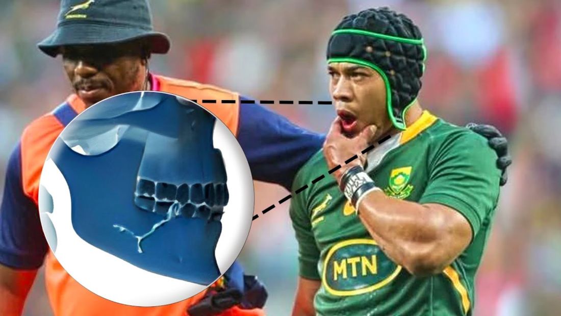 Rugby Championship: Cheslin Kolbe estará ausente en el debut