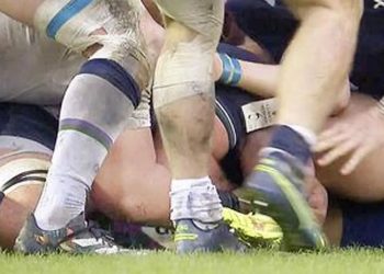 En Escocia todas las miradas apuntan a World Rugby