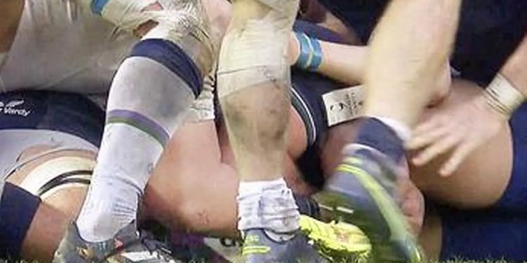 En Escocia todas las miradas apuntan a World Rugby