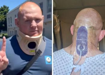 Steven Kitshoff se sometió a una compleja cirugía